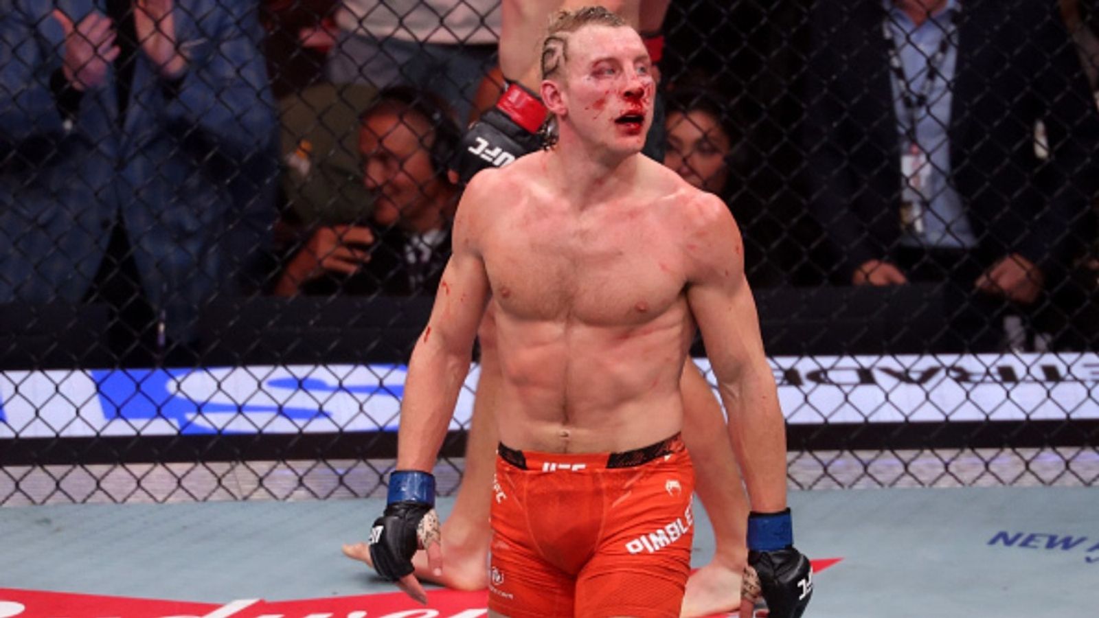 Paddy Pimblett breaks silence on injury after tough loss to Justin Gaethje at UFC 324 Paddy Pimblett breaks silence on injury after tough loss to Justin Gaethje at UFC 324