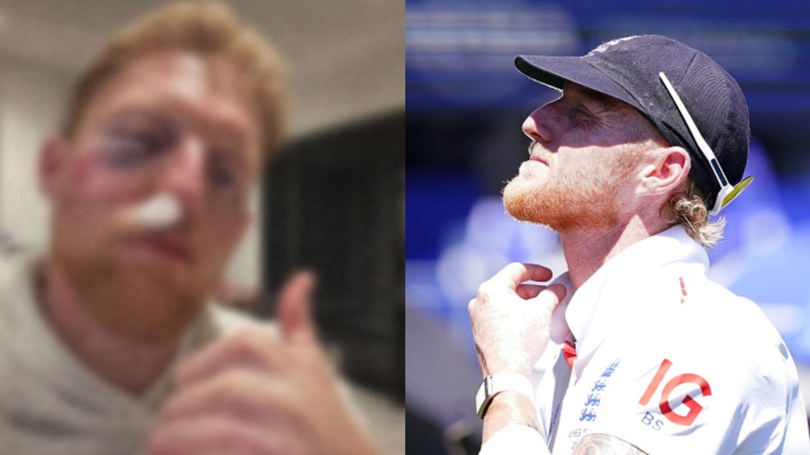 Ben Stokes face looks horribly unrecognisable after horrendous injury, vows to never skip wearing helmet England's Test captain Ben Stokes in frame. (Getty)