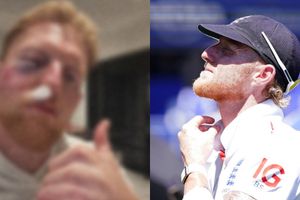 Ben Stokes face looks horribly unrecognisable after horrendous injury, vows to never skip wearing helmet SportsTak