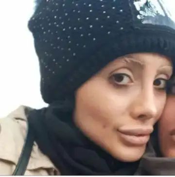 इस देश की हीरोइन बनना चाहती थी एंजलिना जोली जैसी पर बन गई ऐसी, लोग डरने लगे