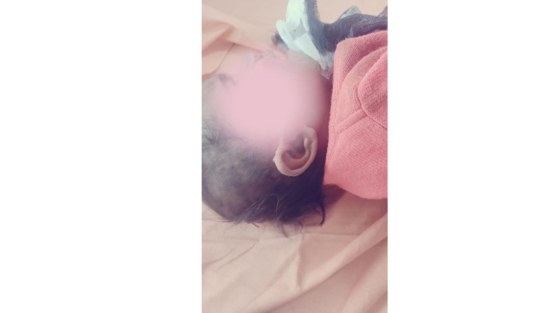 गाजियाबाद में सवा साल की मासूम बच्ची को कुत्ते नोच डाला