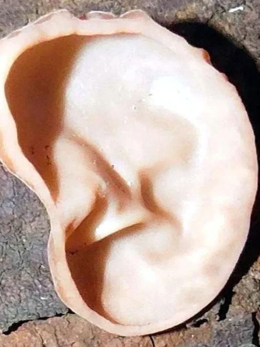 গাছে গজিয়েছে মানুষের 'কান'! আশ্চর্যজনক 