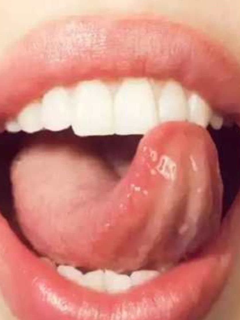 জিভের রঙ ও গঠন দেখেই চিনুন মানুষ