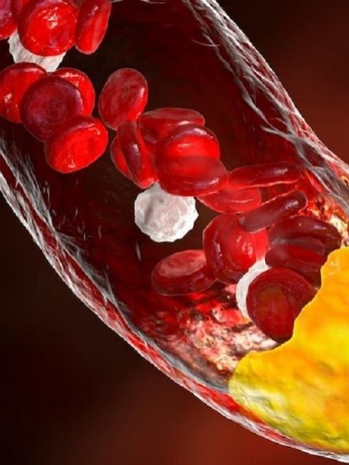 बालों से जुड़े ये दो संकेत देख समझ जाएं कोलेस्ट्रॉल हो गया है हाई, तुरंत दें ध्यान