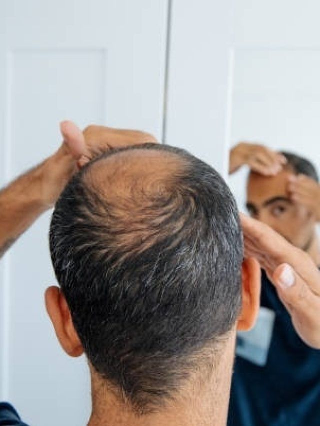 रोजाना ये एक चीज पीने से तेजी से बढ़ने लगता है गंजापन, पहले ही हो जाएं सावधान