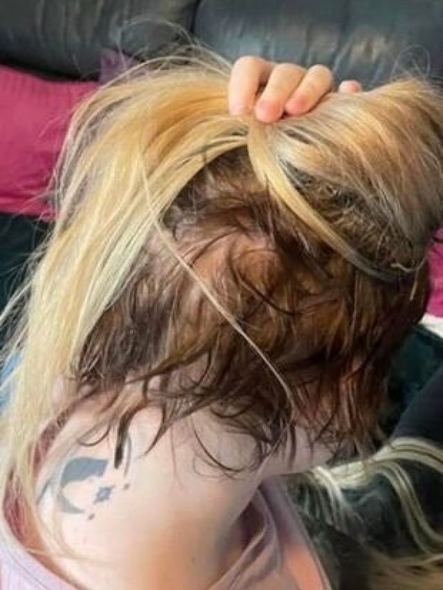 हेयर एक्सटेंशन के बाद हुआ पछतावा! लड़की की बिगड़ी हालत, शेव कराना पड़ा सिर