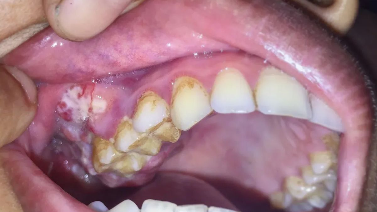 Chex massajini onlayn tomosha qiling