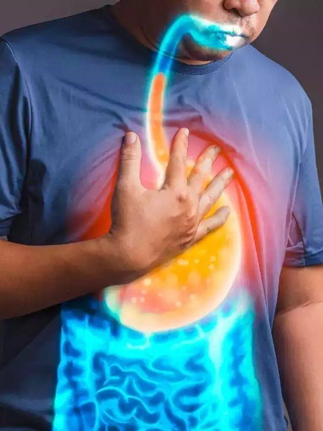 অ্যাসিডিটি থেকে মুক্তির ঘরোয়া উপায়