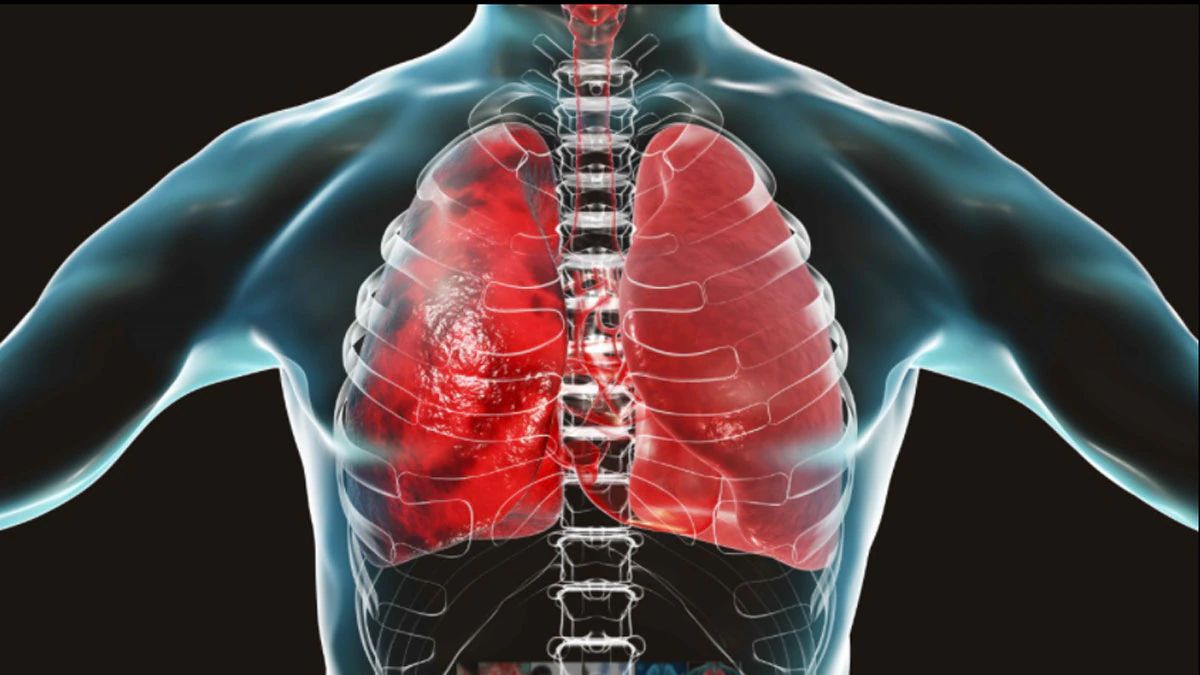 lung87788787