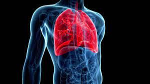 lung8787878787