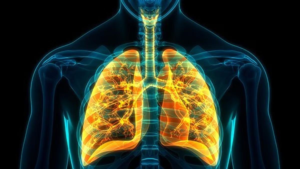 lung887878778