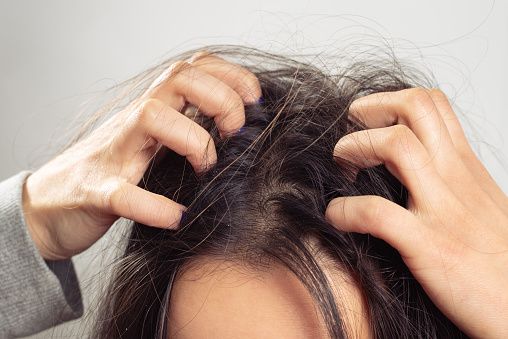 scalp ithcing 3