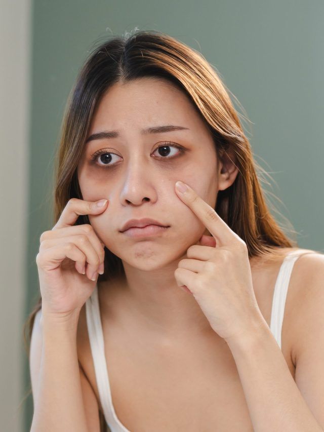 Are you suffering from dark circles? Here is how coffee can cure it!