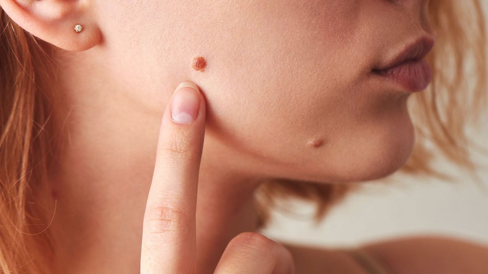 Yalangoch yovvoyi olmalarning barcha fotosuratlari Jinsiy aloqa Volgagrad