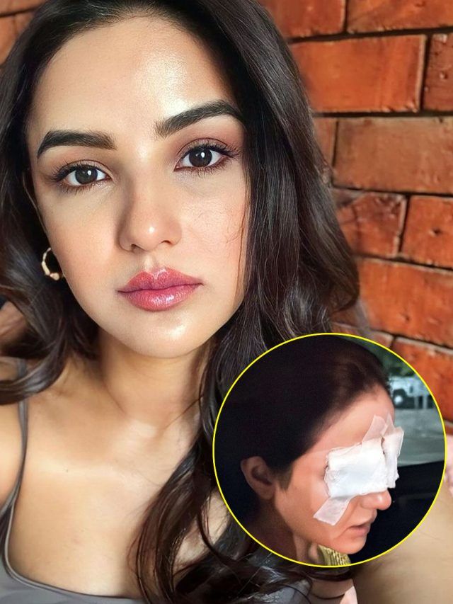 दिखना हो गया था बंद, अब कैसा है जैस्मिन की आंखों का हाल? बोलीं- खतरे से बाहर...