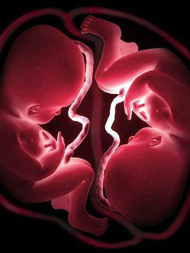 Bad Newz: क्या जुड़वां बच्चों के हो सकते हैं अलग-अलग पिता? जानें सच्चाई