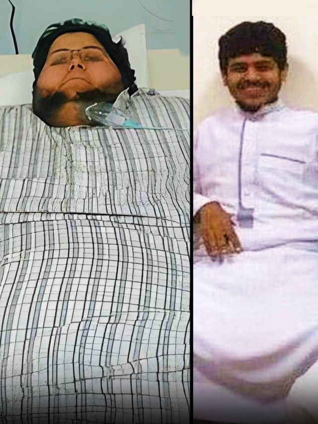 610 किलो के लड़के ने घटाया 542 Kg वजन...अब वेट है 63.5 किलो, इस चीज से मिला फायदा