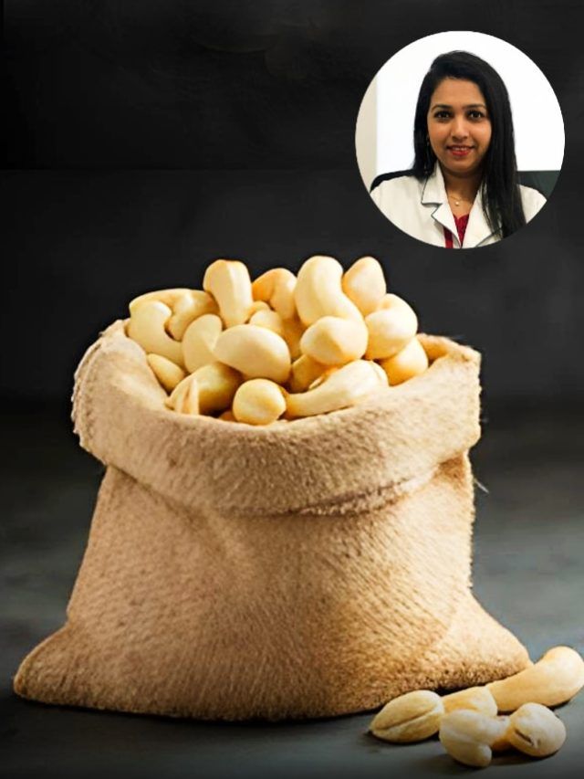 रोजाना कितने काजू खाने चाहिए? इस तरीके से खाएंगे तो होगा फायदा, मुंबई की डायटीशियन ने बताया