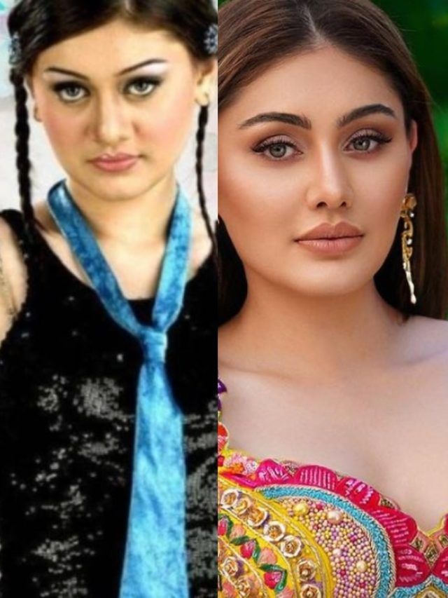 'कांटा लगा गर्ल' ने कराया बोटॉक्स, लिए दर्दनाक लिप इंजेक्शन्स, बदला लुक देख फैन्स हैरान