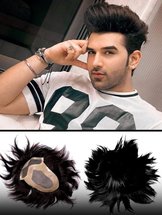 नकली बाल लगाते हैं पारस छाबड़ा, किया खुलासा...जानें पुरुषों के बाल झड़ने के कारण और इलाज