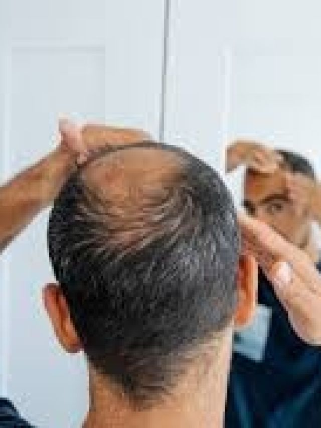 कुछ महीनों में ही दूर होगा गंजापन! आचार्य बालकृष्ण ने बताया अचूक उपाय