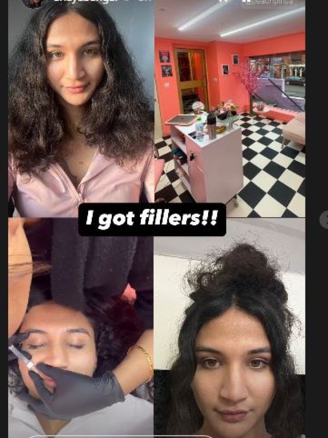 लड़के से लड़की बने क्रिकेटर के बेटे ने चेहरे पर ये चीज क्यों लगवाई? ये हैं साइड इफेक्ट