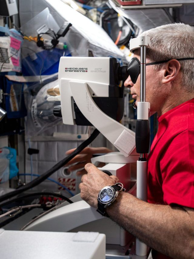 Space blinds astronauts? NASA uncovers chilling eye risks for future Mars missions