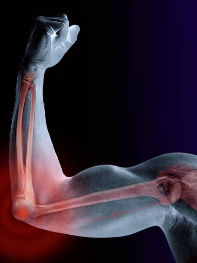 देसी घी में भूनकर खाएं ये सफेद ड्राई फ्रूट, बुढ़ापे तक मजबूत रहेंगी हड्डियां