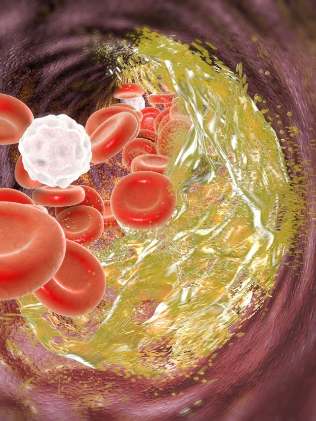 गंदे कोलेस्ट्रॉल को निकालना चाहते हैं शरीर से बाहर? इन चीजों से कर लें दोस्ती