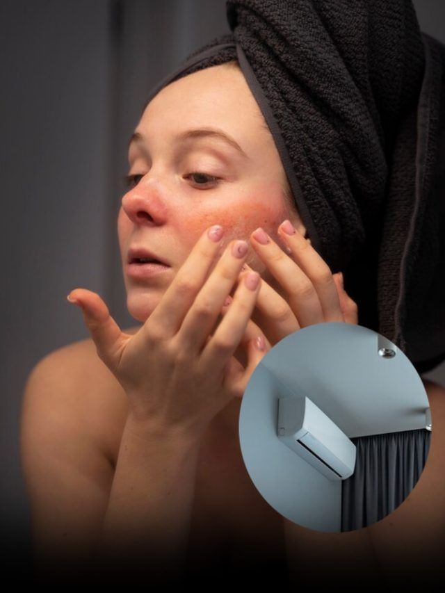 AC की ठंडी हवा से कैसे खराब हो रही स्किन? डर्मेटोलॉजिस्ट ने बताया कारण और ट्रीटमेंट