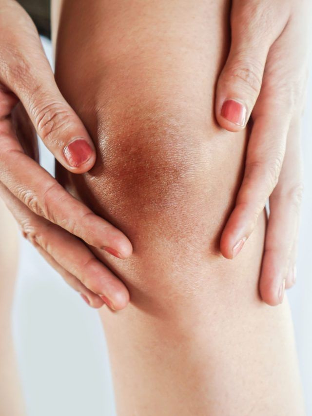 काली पड़ गई है घुटने और कोहनी की स्किन? इन घरेलू उपायों से मिलेगी मदद