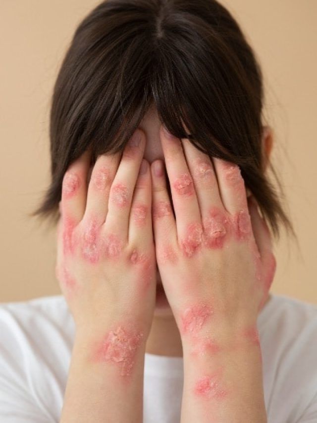 दाद, खाज..खुजली से कैसे पाएं निजात? अपनाएं आयुर्वेदिक डॉक्टर के ये टिप्स