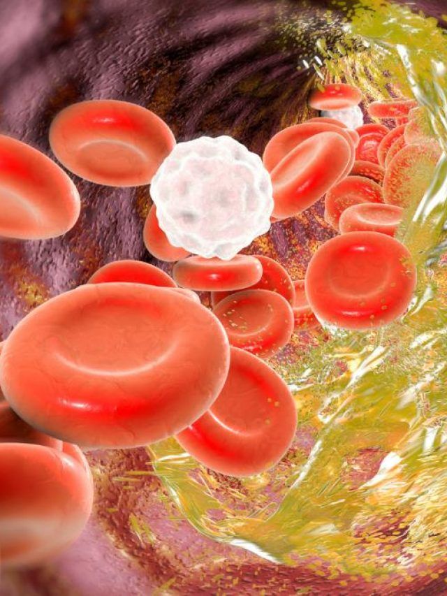 कोलेस्ट्रॉल बढ़ने का कारण बन सकती हैं आपकी ये आदतें, आज ही कर लें बदलाव