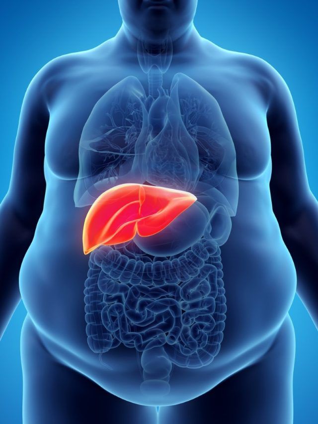 फैटी लिवर की समस्या के लिए बेहद फायदेमंद है ये ड्रिंक, जानें बनाने का तरीका