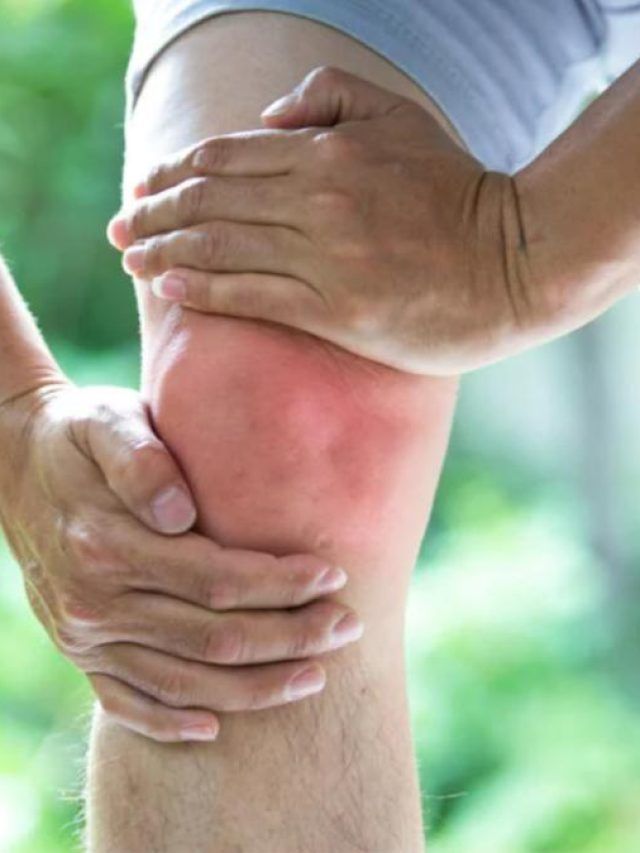 यूरिक सिडके लेवल को करना चाहते हैं कम? इन आयुर्वेदिक उपायों से मिलेगी मदद