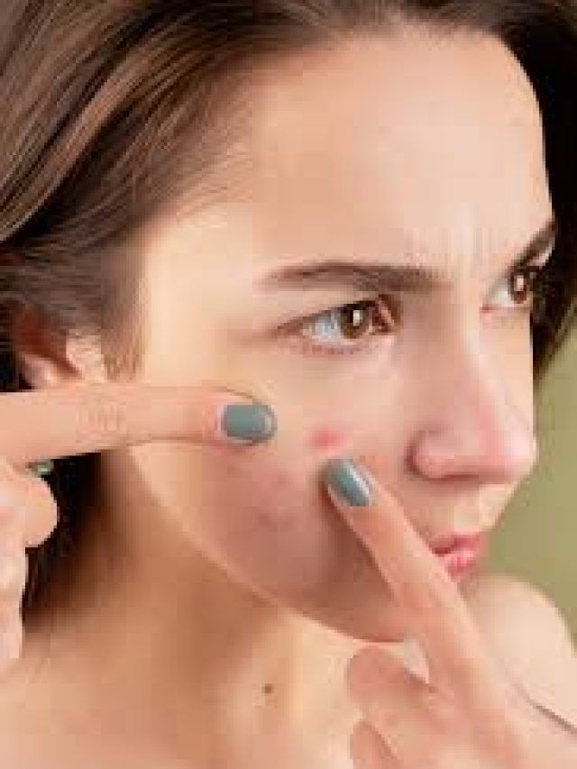 क्या आप भी खा  रहे हैं ये 3 सप्लीमेंट्स? स्किन पर बढ़ सकते हैं Pimples