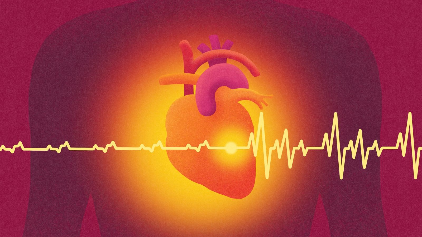 Diabetes increases risk of heart disease