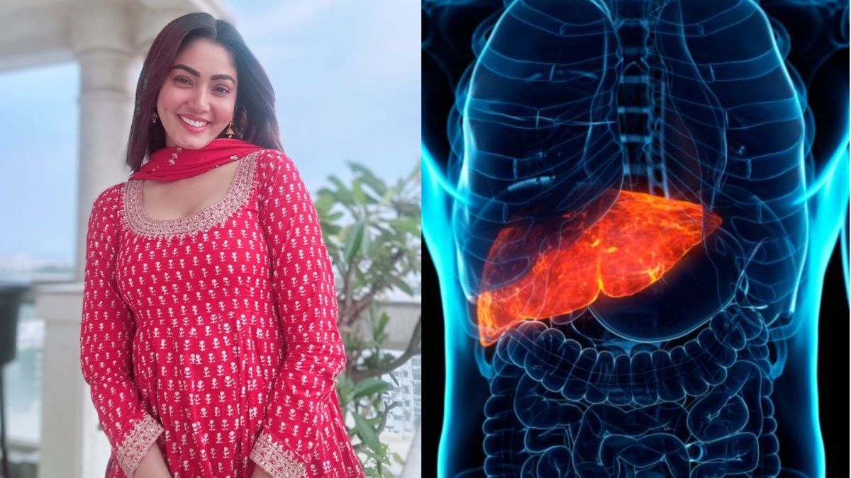 लिवर सिरोसिस से जूझ रहीं सना मकबूल, जानें फिट इंसान को क्यों घेरती है ये जानलेवा बीमारी - आज तक