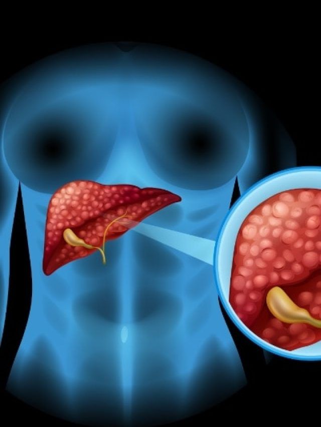ये 7 चीजें कर रही महिलाओं के लिवर को खराब! ध्यान ना देने पर हो सकता है फेल