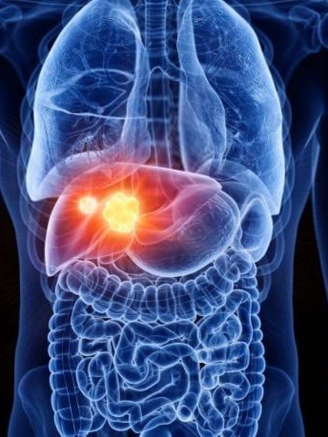 लिवर के लिए 'जहर' से कम नहीं ये फूड्स, एक तो रोज खा रहे हैं आप