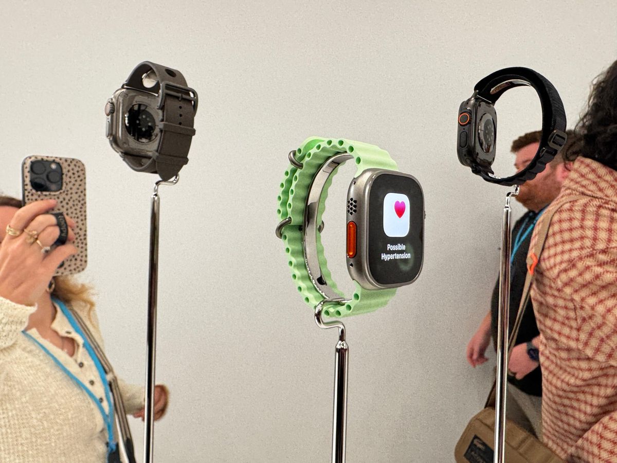 Apple watch liteITG 1757444566999