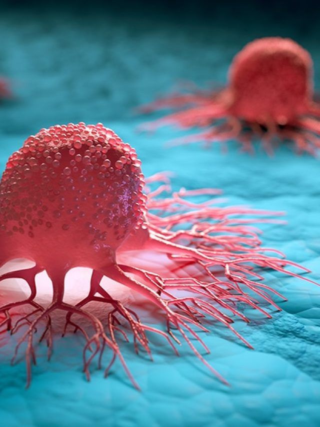 A deadly epidemic unfolds: The real reasons cancer is surging in India