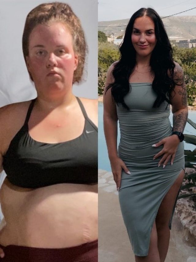 खाने की बीमारी से लड़कर महिला ने घटाया 72 kg वजन, अपनाया ये तरीका