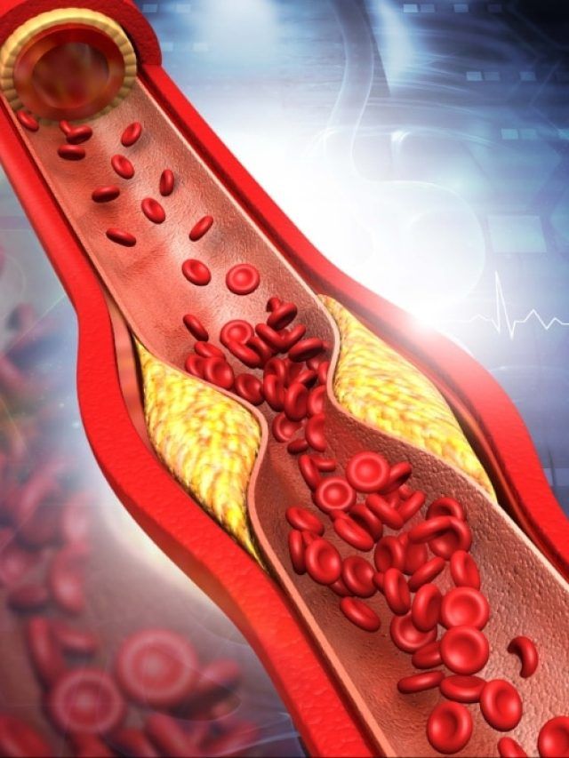 नसों में जमा गंदा कोलेस्ट्रॉल निकाल फेंकेगी ये एक चीज, रोज बस ऐसे करें सेवन