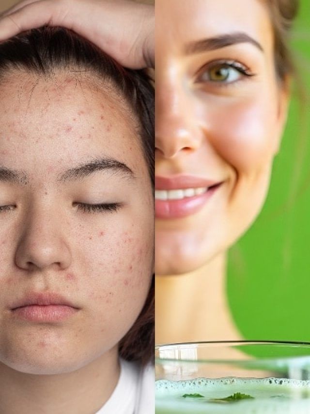 सोने से पहले पिएं ये 'जादुई' पानी, 1 हफ्ते में पिंपल्स होंगे छूमंतर!