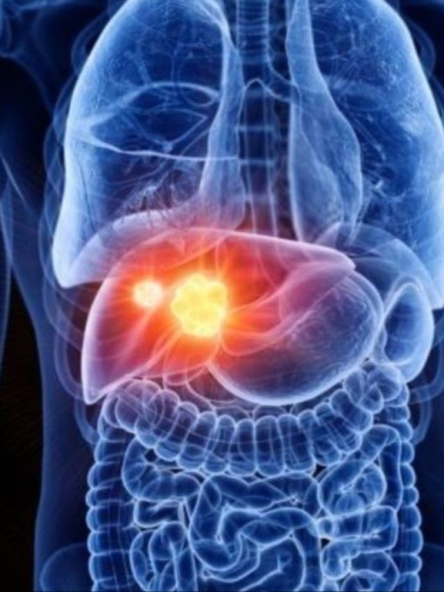 खुजली, मतली और पेशाब के रंग में चेंज... ये संकेत बताते हैं आपका लिवर हो रहा खराब