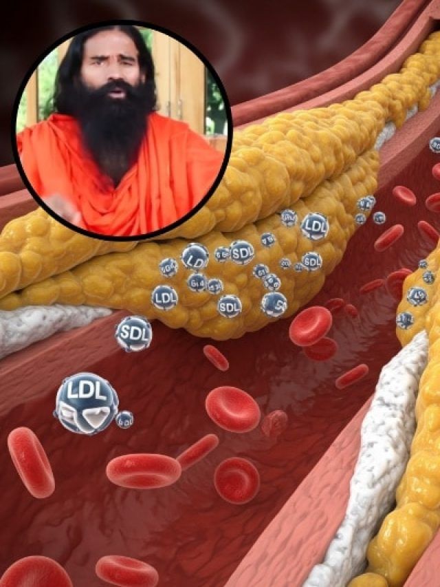 बढ़े हुए कोलेस्ट्रॉल से हैं परेशान? अपनाएं बाबा रामदेव के ये देसी नुस्खे