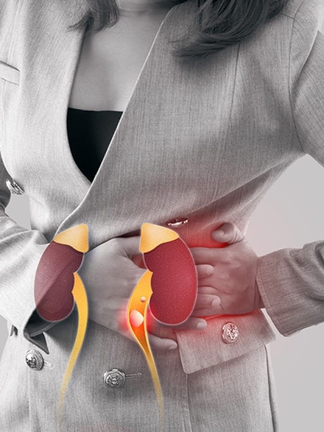 Not just genetics: how common foods may harden into kidney stone risk