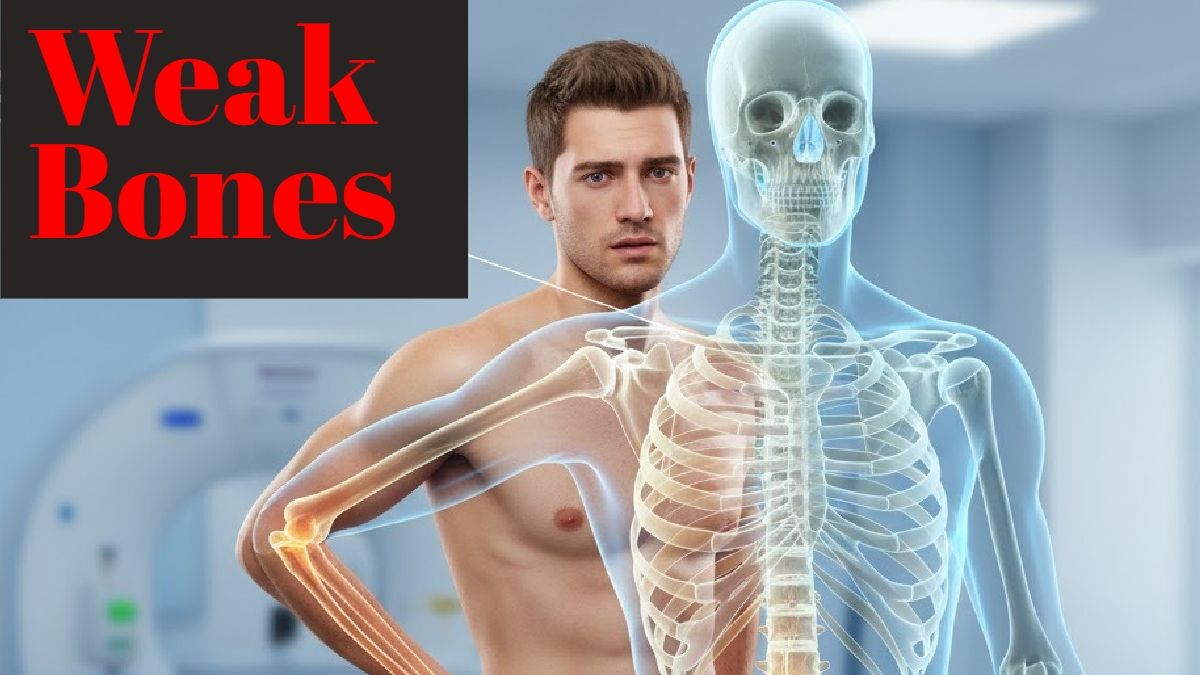 कम उम्र में खोखली हो रही हैं हड्डियां? सिर्फ कैल्शियम नहीं, ये भी है वजह, हो जाएं सावधान