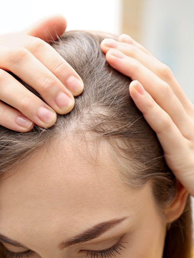 The diabetes-hair loss connection: Why your scalp may be suffering from high blood sugar
